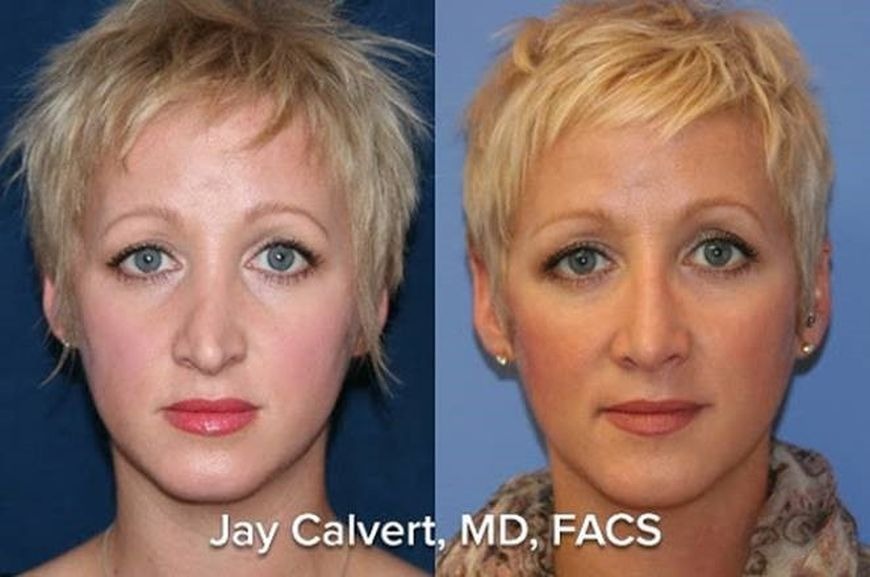 Dr. Calvert Dr. Calvert